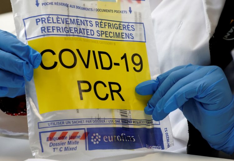 ¿Cada cuánto debo hacerme una prueba de COVID-19? FOTO / AFP.