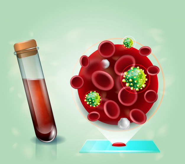 vih virus prueba sangre concepto vector realista 81522 59
