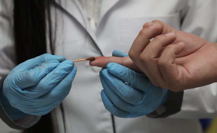 Entre los productos utilizados para la prueba se encuentra la acetona, el ácido muriático y el yoduro de potasio. / FOTO: Guillermo Martínez