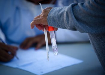 El Salvador contabiliza más de 800 mil pruebas PCR aplicadas a la población