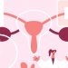 La menopausia: una etapa natural