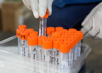 El Salvador ha realizado más de un millón de pruebas para COVID-19