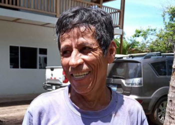 Salvadoreño que trabaja en construcción logra restaurar su dentadura con sus ahorros en Bitcoin