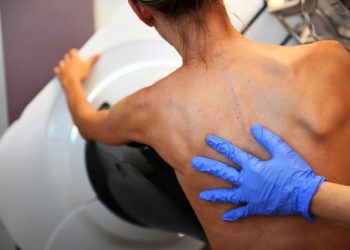 La mamografía para detectar el cáncer de mama provoca debate médico en Europa