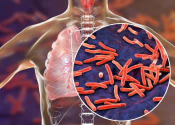 El número de muertos por tuberculosis sube por la pandemia de covid-19