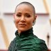 Celebridades y figuras públicas y su «dolorosa» relación con la alopecia