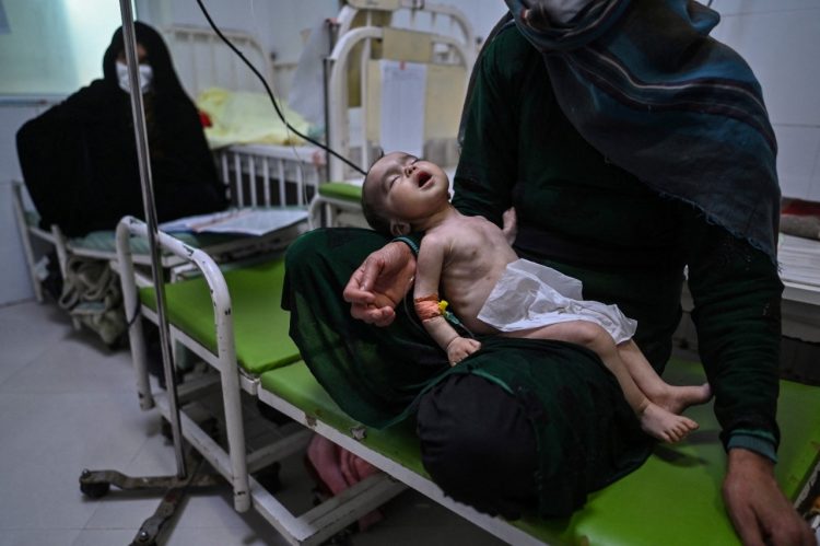 Inseguridad alimentaria. ACNUR señaló que las salas de los hospitales en Afganistán está llenas de bebés que pesan en un año lo que pesaría un menor de  seis meses.  Foto AFP.