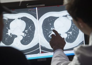 Mayor gasto de EE. UU. en cáncer no mejora la tasa de sobrevivencia, dice estudio