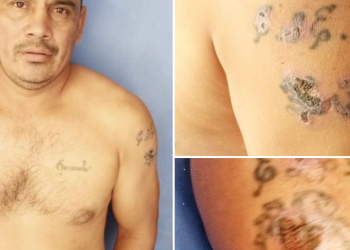 Pandillero intentó quemar sus tatuajes por temor a las autoridades, pero fue capturado en San Vicente
