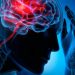 Nuevo estudio sobre covid en EEUU ayuda a comprender la «niebla cerebral»