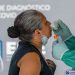 Ministerio de Salud realiza jornada de tamizaje en parque San Martín, San Salvador