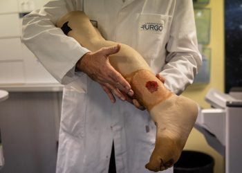 Creando una piel artificial para cicatrizar las quemaduras graves