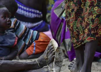 Hambruna mortífera se extiende en África, informan la ONU y oenegés