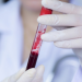 Un nuevo tratamiento reduce 74 % avance de un raro cáncer de sangre