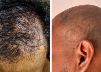 Capturan a marero que dejó crecer su cabello para ocultar tatuajes de la MS