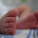 Casos de sífilis en recién nacidos se dispararon en EE. UU. en 2022