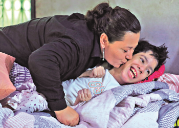 Yanci, el singular caso de anencefalia que llega a una edad avanzada