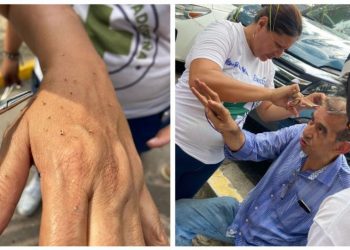 Ataque de abejas en Santa Tecla deja varias víctimas
