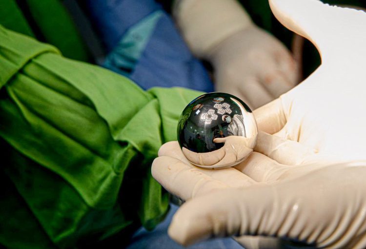 En la imagen se muestra la prótesis de cabeza de fémur que se coloca a los pacientes que requieren la sustitución de esta parte del hueso. Foto: Ministerio de Salud.