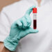 FDA aprueba nuevo examen de sangre para detectar cáncer de colon